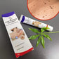 Wart Remover Ointment